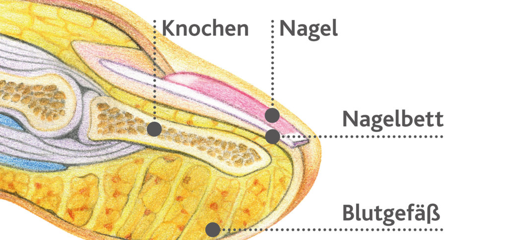 Typische Symptome von Nagelpilz